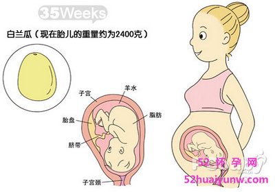 怀孕35周胎儿图（1）