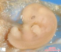 子宫内胎儿各个时期图片