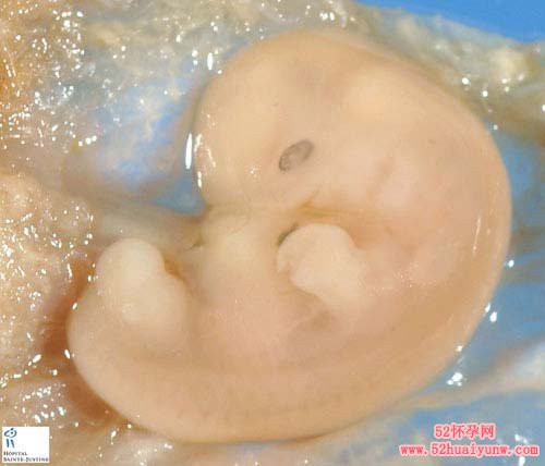 6周时子宫内胎儿图片