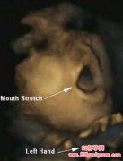 胎儿子宫内吮手指【高清3D图】